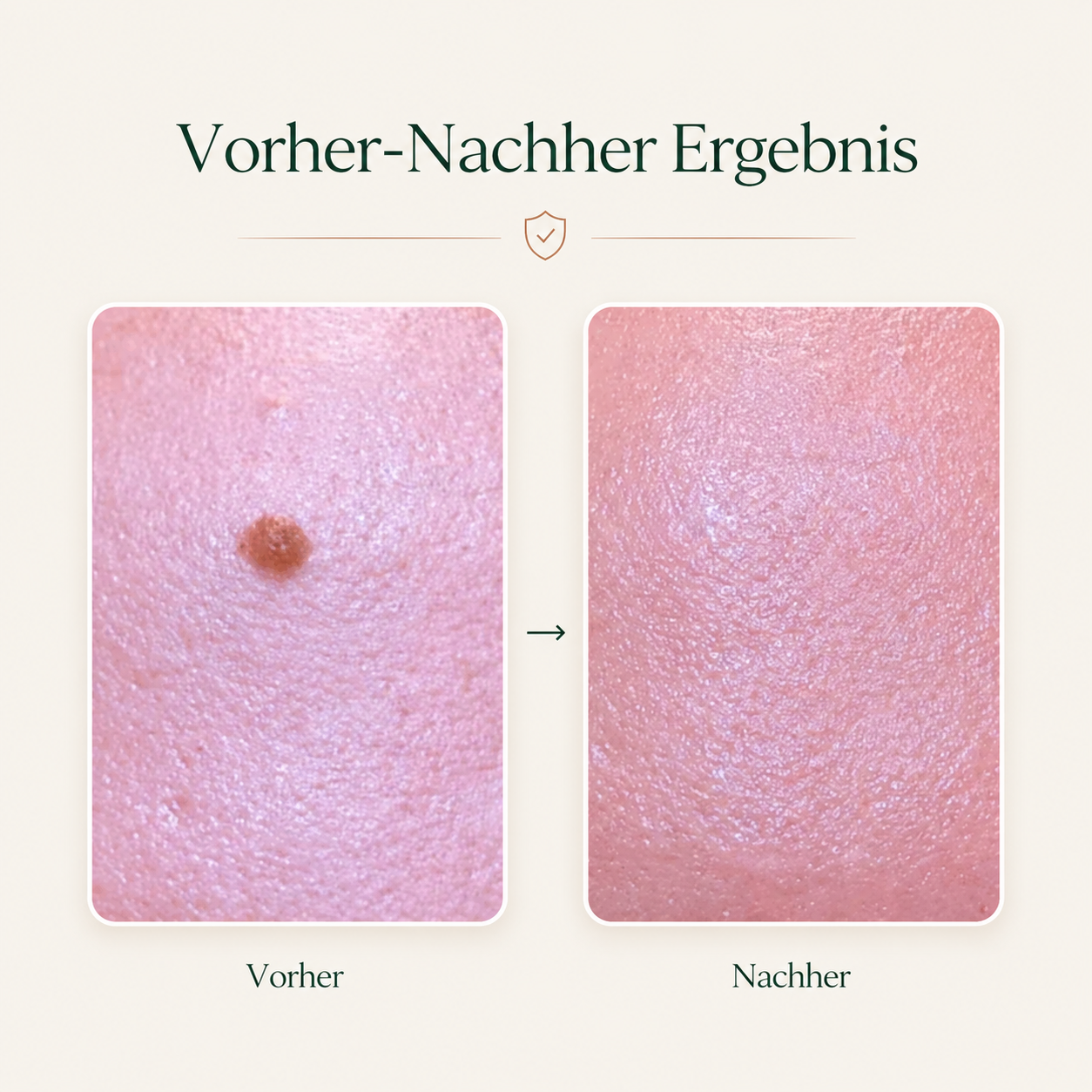 Vorher-Nachher-creamole
